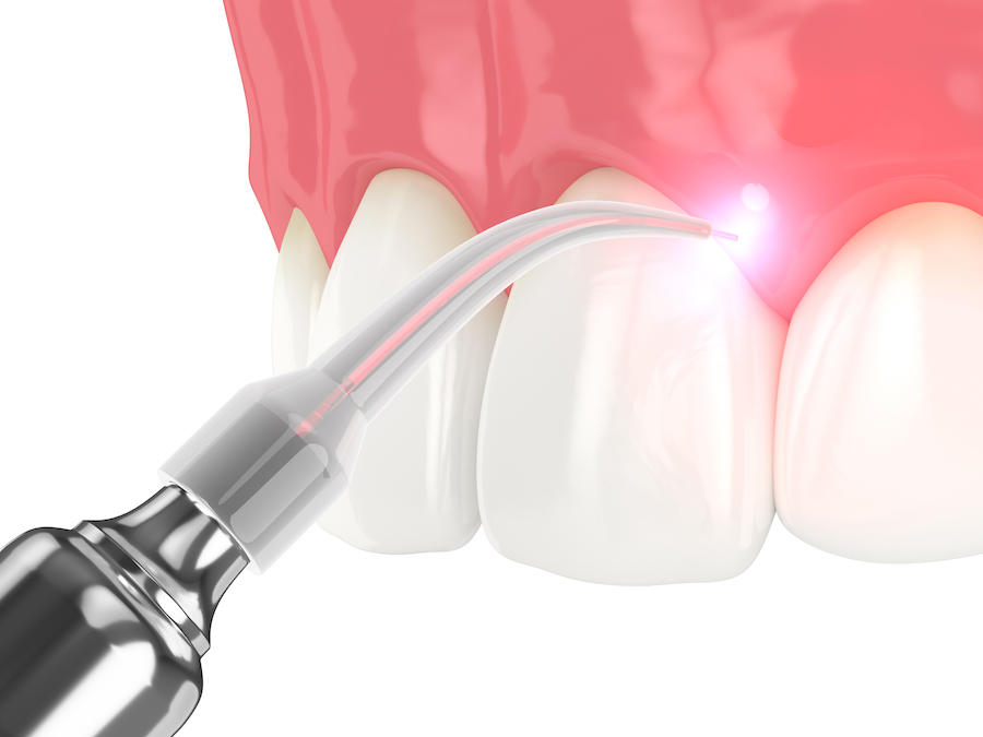 dental technology, state-of-the-art, laser dentistry